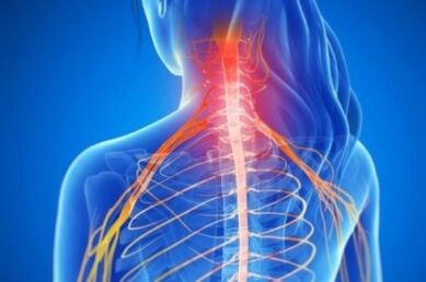 Sindrome di Rook